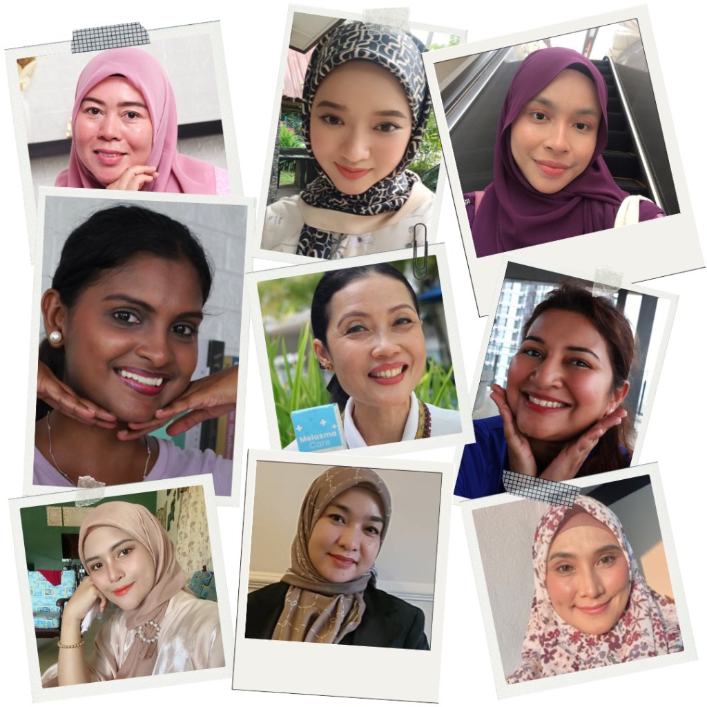 Melasma-Care-Testimoni