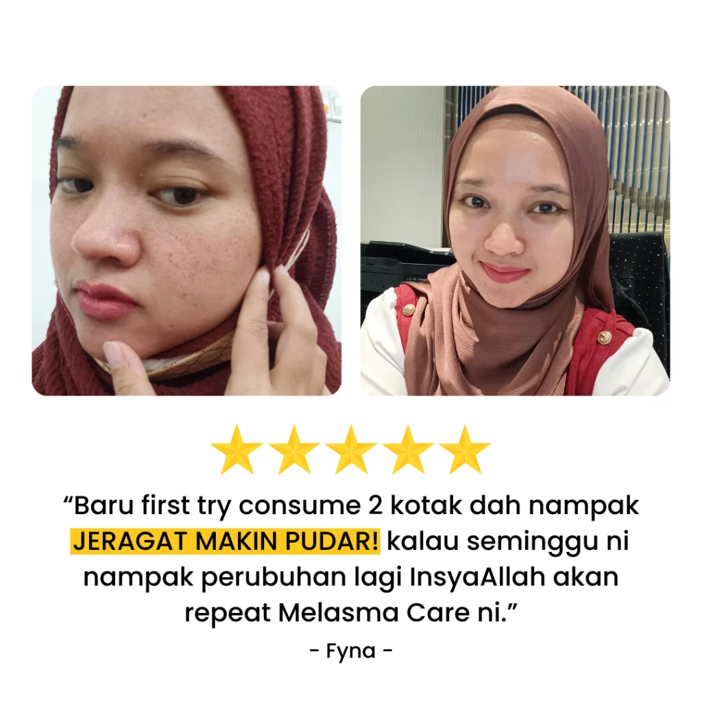 Testimoni-Melasma-Care