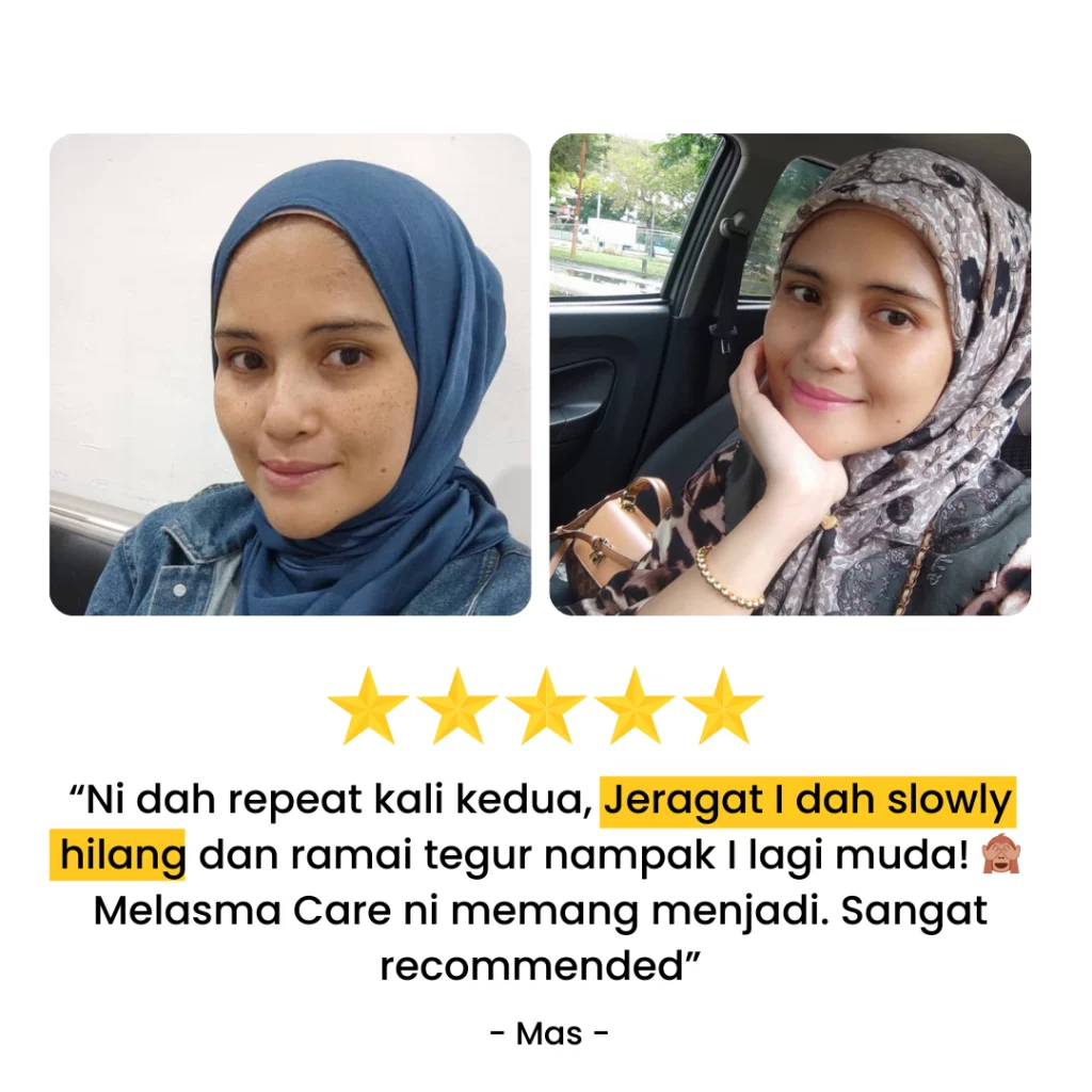 Testimoni-Melasma-Care