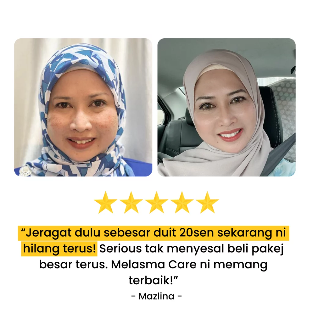 Testimoni-Melasma-Care