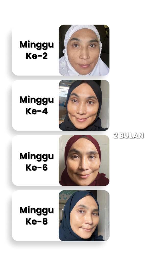 Testimoni-Melasma_Care